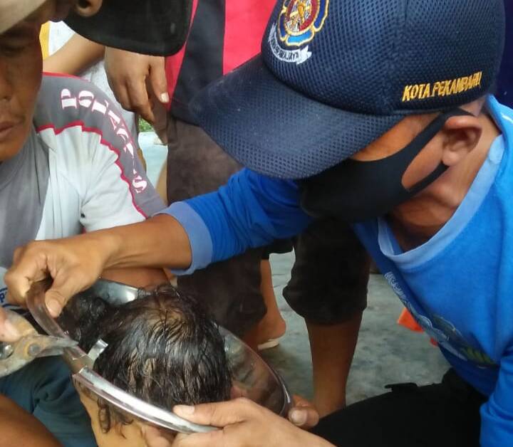 Tutup Panci Sempat Nyangkut di Kepala Balita Ini